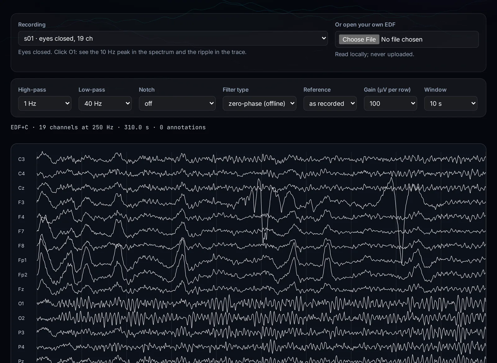 Signal Lab: a 19-channel eyes-closed EEG recording in the browser with high-pass, low-pass, notch, reference and gain controls